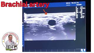 Arterial pulsation examination importatnt Tip Dr Alaa Nasr 2024 [upl. by Kjersti]