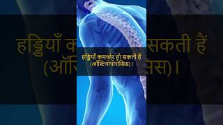 Steroid Therapy के नुकसान  Causes of Steroid Therapy  Best Intensivist in Kanpur [upl. by Enimisaj]