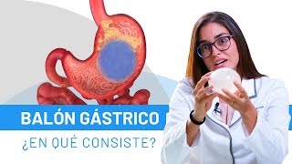 BALÓN GÁSTRICO Todo lo que necesitas saber  Resuelve tus dudas [upl. by Eizle]