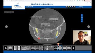 Explaining case 26 of the ASAS Online Case Library [upl. by Nwahsed]