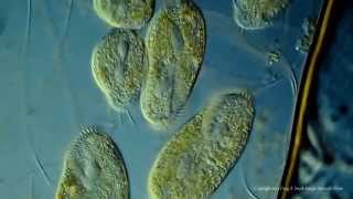 Various Ciliated Protozoa Kingdom Protista DIC Lighting Technique [upl. by Benco]