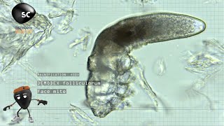 The Science of Bacteria  Life on Us [upl. by Thurnau]