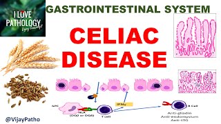 Celiac disease Etiopathogenesis Morphology amp Clinical features GIPath ilovepathology [upl. by Hanshaw452]