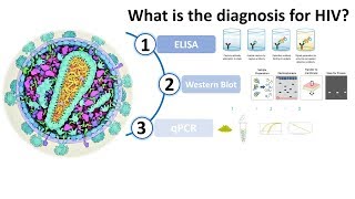 Diagnosis of HIV AIDS [upl. by Natalie]