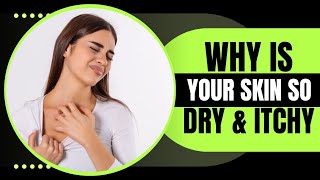 10 Reasons Behind Your Dry Itchy Skin – And How to Prevent It [upl. by Yssep941]