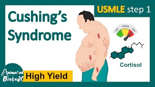 Cushings syndrome  How is Cushing syndrome diagnosed  Treatment of Cushings syndrome  USMLE [upl. by Leis980]