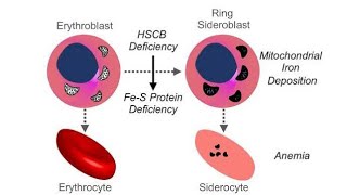 Drug Treatment for Sideroblastic Anemia [upl. by Yednarb]