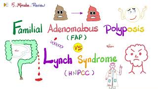 FAP vs Lynch Familial Adenomatous Polyposis vs Hereditary Nonpolyposis Colorectal cancer Oncology [upl. by Aicillyhp]