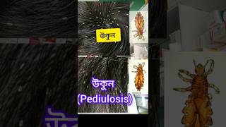 Pediulosis উকুন [upl. by Daloris]