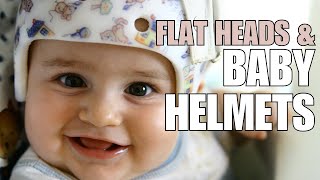 Pediatrician Explains Plagiocephaly Flattening of Head and Helmeting Baby Helmets [upl. by Dripps703]