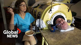 ‘Iron Lung Man’ dies at 78 after more than 70 years of paralysis from polio [upl. by Arahsal]