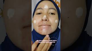 H2 KRIM PENETRALTABIR SURYAZULFA SKIN CLINIC PACITAN [upl. by Oriole419]