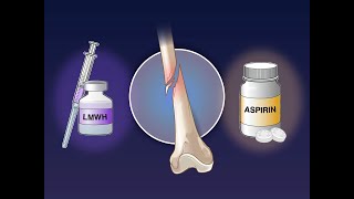 Aspirin vs LowMolecularWeight Heparin after a Fracture  NEJM [upl. by Nelleeus665]