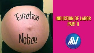 Induction Of Labor Part II [upl. by Charil]