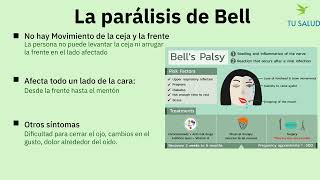 Parálisis de Bell vs Derrame Cerebral Aprende a Diferenciarlos en Un Minuto [upl. by Anedal]