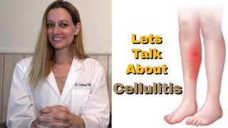 CELLULITIS Everything You Need To Know Symptoms Cause Risk Factors Treatment Prevention [upl. by Gottfried]