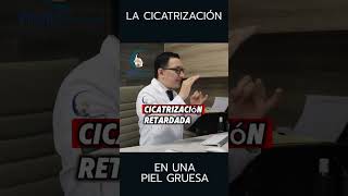 Cicatrización en piel gruesa  PlasticFacial MX [upl. by Ybok557]