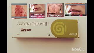 Zoster cream  Zoster cream uses side effects acyclovir cream use acyclovir cream review [upl. by Nicko343]