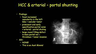 ultrasound radiologysonology [upl. by Beckerman654]