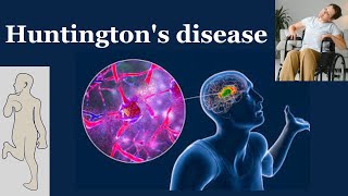 UPSC  Huntingtons disease  Huntingtons chorea  UPSC Prelims 2024 science and tech [upl. by Anirroc166]