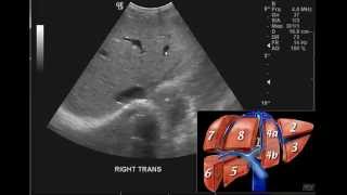 Introduction to the interpretation of Abdominal Ultrasound [upl. by Windy]