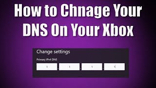 How to Change Your DNS on Your Xbox One Console [upl. by Ellinad]