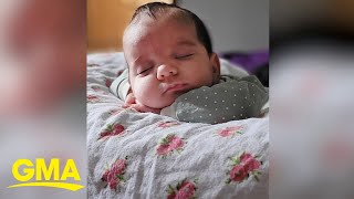 Baby girl born with rare 4pound tumor [upl. by Ileyan]