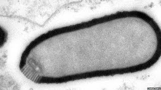 Virus Resurrected After Being Frozen For 30000 Yrs  Pithovirus Sibericum [upl. by Naerad549]