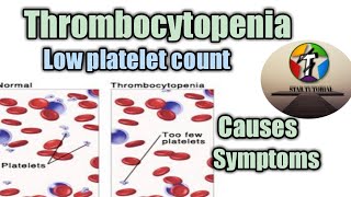 Thrombocytopenia in hindi ll Low Platelet Count ll Hematology And Blood Banking [upl. by Ardied]