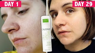 I Tried Caudalie Grape Water 30 Day Review [upl. by Annawoj23]