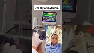 Deadly arrhythmia highlights [upl. by Ahsuatal]