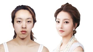 Top 5 Drastic Korean Plastic Surgery TV Show Transformations  Seoul Guide Medical [upl. by Arod]