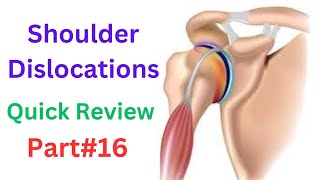 Shoulder dislocations  Anterior dislocation  Posterior dislocation  Inferior dislocation [upl. by Usanis328]