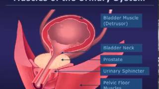 Botox Injections for Bladder Conditions [upl. by Tenn]