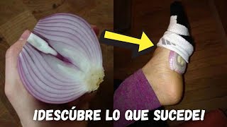 ✅ BENEFICIOS de la CEBOLLA en los PIES por la NOCHE ¿Para qué SIRVE Es BUENO DORMIR con CEBOLLA [upl. by Wyatan615]