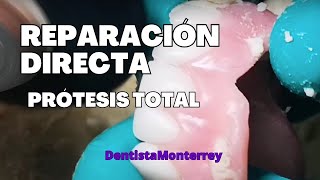 REPARACIÓN DIRECTA👅en1Cita PRÓTESIS TOTAL SUP [upl. by Hakceber413]