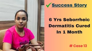 Case 13  Bengali  Seborrheic Dermatitis of 6 years cured within 1 month by homeopathy [upl. by Deckert]