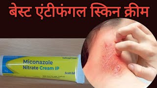 Miconazole Antifungal creamMicogel Antifungal cream Miconazole Nitrate CreamuseApplyside effect [upl. by Atthia]