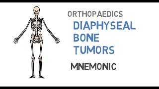 Diaphyseal bone tumors [upl. by Euphemia921]