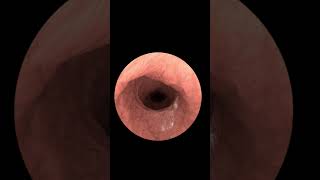 Exploring Your Insides with Gastrointestinal Endoscopy Animation 2024 [upl. by Ramburt]