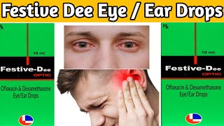 festive dee  festive dee optic eyeear drops ofloxacin dexamethasone eye ear drops [upl. by Hcurob]