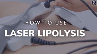 How to use Laser Lipolysis bodysculpting [upl. by Leahcim]