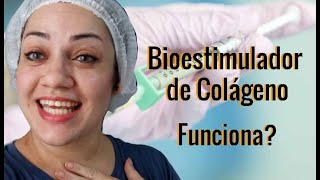 Bioestimulador de Colágeno funciona [upl. by Kenney]