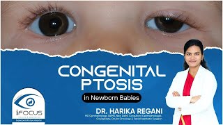 Congenital Ptosis in Newborn Babies  Dr Harika Regani Ophthalmologist in Vijayawada [upl. by Trinette555]