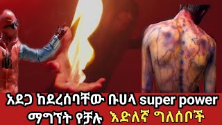 አደጋ ከደረሰባቸው ቡሀላ super power ማግኘት የቻሉ እድለኛ ግለሰቦችamaizing peoplesZena Addis ethiopia [upl. by Nosmas]