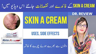 Dr Reviewed SKIN A CREAM  Uses  Side Effects  Tretinoin Cream  Beauty Facts  UrduHindi [upl. by Letizia]