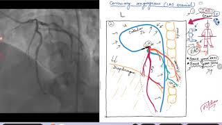 Coronary Angiogram LAO cranial view [upl. by Thurmond]