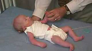 neurology exam newbornabnormal Primitive Reflexes  Moro [upl. by Berkman]