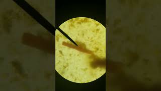 Microbiology Strongyloides stercoralis [upl. by Rekrap]