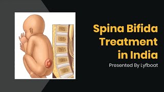 Spina Bifida Treatment in India  Spina Bifida Surgery Cost in India [upl. by Karim]